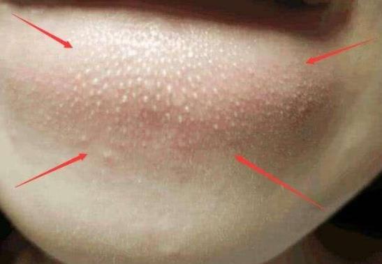 �۴������x����Ć᣿���ȥ���۴̣�