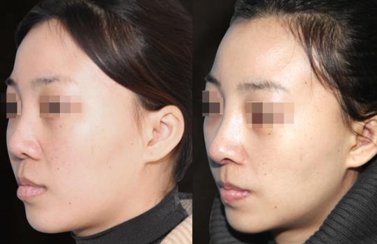 ��С�����L���gЧ����Σ��|��С����������Щ��