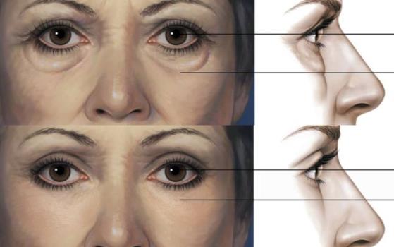 ���w֬�����I�ϰ�ȫ�᣿����Щ���ɣ�