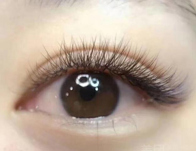 �޽ӽ�ë��ȫ�᣿�޽ӽ�ëҪע��ʲô��