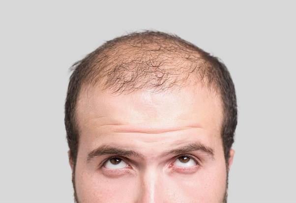 ����Ó�l��ô�k������Ó�l��ʲôԭ�������