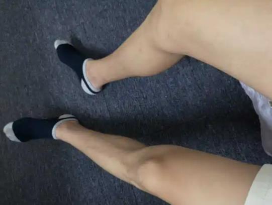 ������ë���f��ʲôԭ����������ë�����I̓��