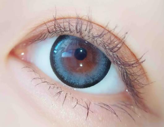 ���p��Ƥ���û֏���Ȼ���p��Ƥ�̺۶����ʧ