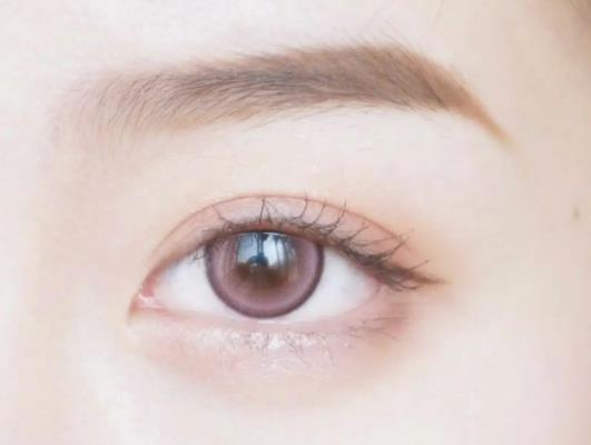 ���p��Ƥ�̺۸���������ʧ���p��Ƥ�̺��܇��ܶ�С������ô�k