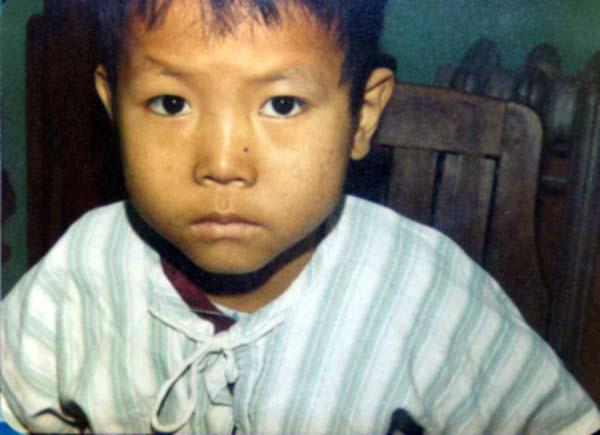 ��ʲôĘɫϞ�S�]Ѫ�� Ęɫ�l(f��)�S��ʲôԭ��