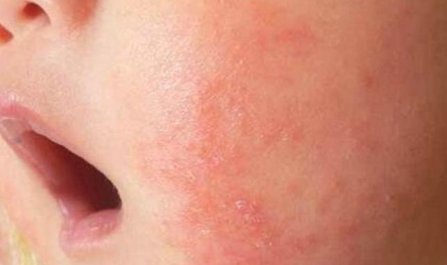 ����������l(f��)��ԭ�򼰰Y�� ������������ô�k