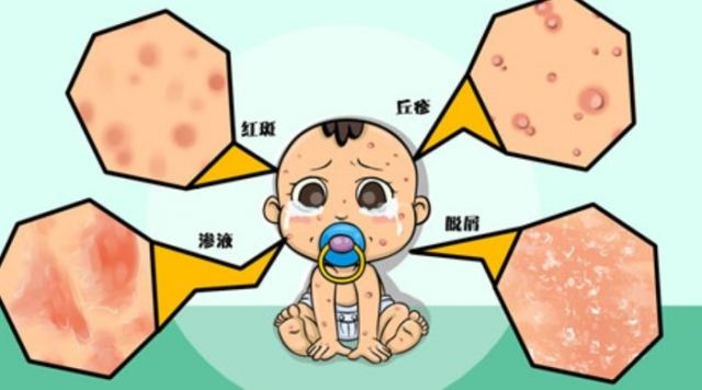 ����������l(f��)��ԭ�򼰰Y�� ������������ô�k