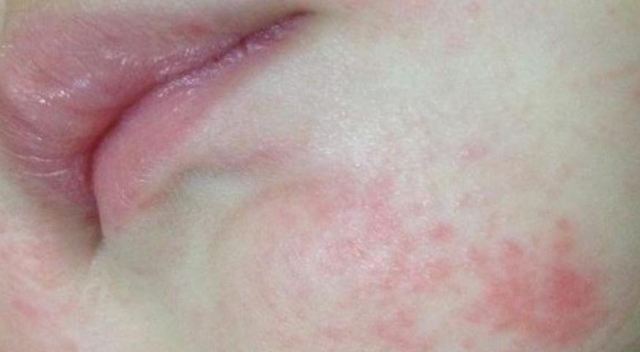 ����İl(f��)������ ��������