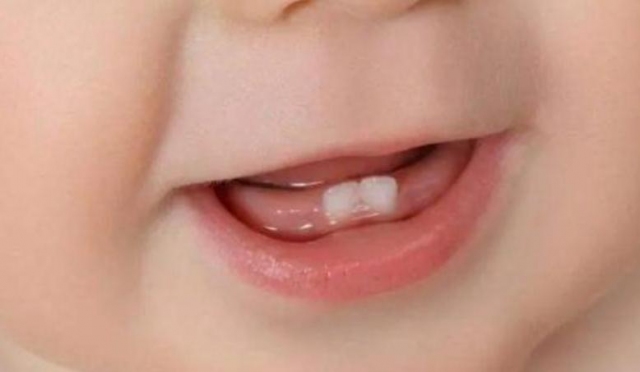 �냺��һ���L��Ҫ���[���죿�냺�L����ʲô�����[