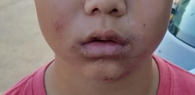 ÿ��(g��)�˶���(hu��)��(du��)â���^��� ��â���^����(hu��)��Ϣ��