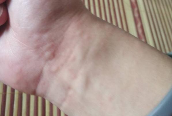 ÿ���˶�����â���^��� ��â���^������Ϣ��