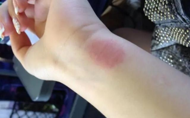 â���^��ԭ����ʲô��  ����Д��ǲ���â���^��