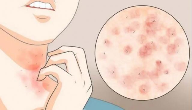 â���^����(hu��)���ˆ� â���p���^���İY��