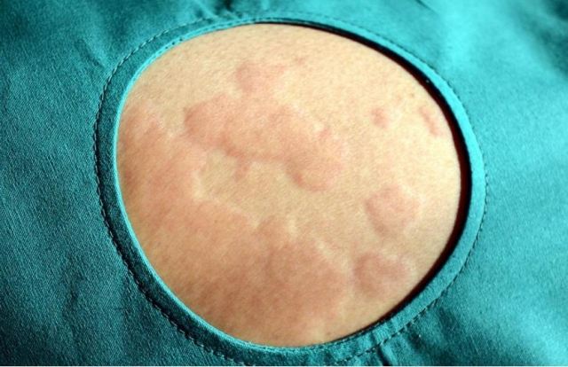 ��â����Ҫע��ʲô���ض��^����ʲô�Y��