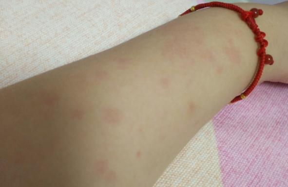 ��â���^������Щ�Y�� â���^�����Ժȗ�֦��¶��