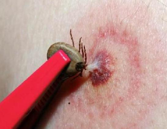 ʮ����Ѫ���x�������F����ª�����������ǂ�Ⱦ�Լ��������g����