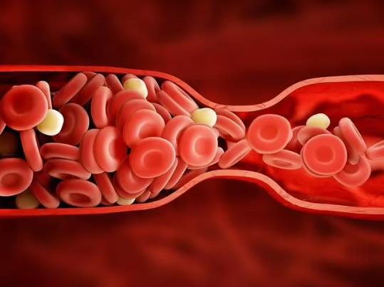 ��ʲô��һ����Ѫ�Ǿ���ȥ�ˣ��賿Ѫ��5.5��Ҫ�a��ţ�̆�