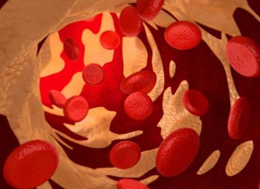 �yѪ�ǵ�һ��Ѫ���ʆ����賿Ѫ��5.5�Ă�С�r��ǰѪ�Ǵ�Ŷ���