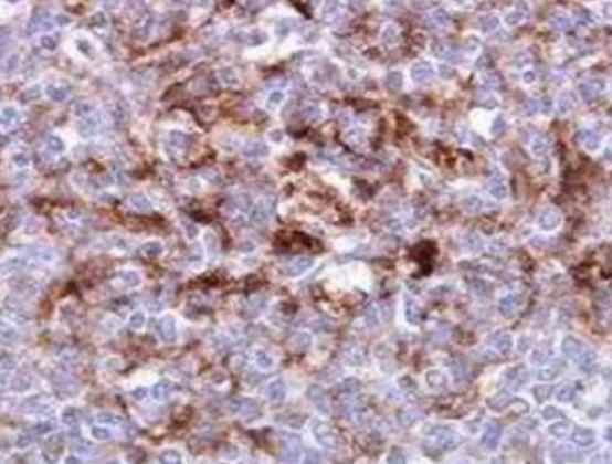 ����ʮ���β����Ĳ�������ƣ�ھC�ϰY����������ʧ�{���������y�ί�