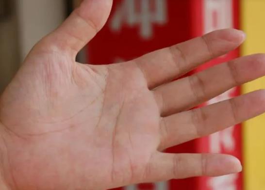 ��ָ�L������ʲôˎ�ࣿ��ָ�ϵ�Ƥ��˺�˶�ú�