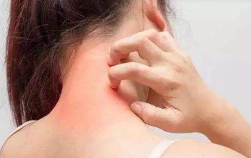 ��Щ�����׼��wȱˮ��ȫ��Ƥ�w������ȱʲô