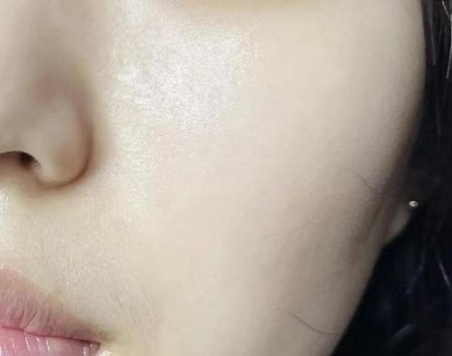 Ę���^�l(f��)���ǝ���؆� Ę���ͺ�Ƣθ���P(gu��n)ϵ��