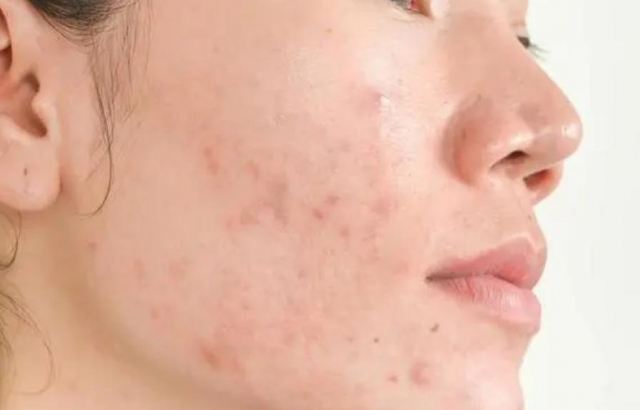 Ę�ϐ۳����ǝ���؆᣿Ę�۳�����ô�{(di��o)��