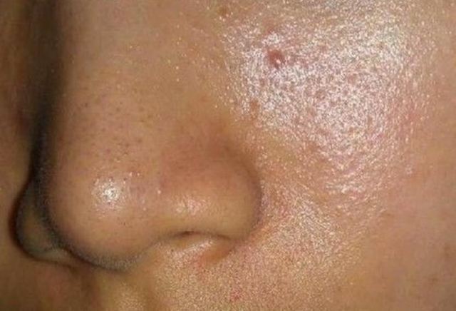 ����Ę�ϳ��ͅ�����ô�k ����Ę�ϳ��͵ĳ�Ҋԭ��