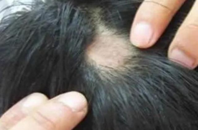 �^�Ī������Ķd�˃ɉK����ô���� ��ʲô�^�l���dһ�K