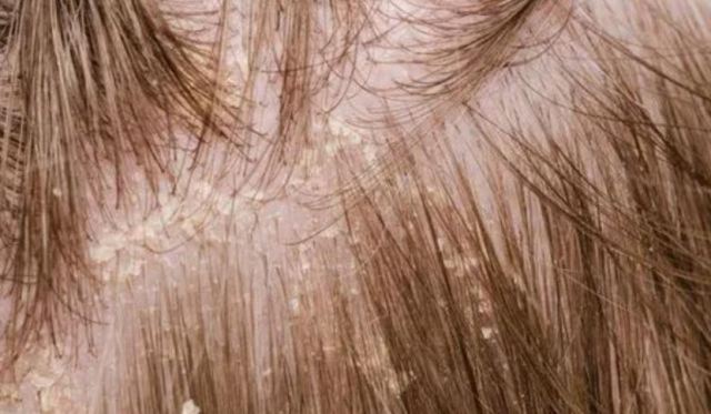 ���^�l(f��)��(y��n)���a(b��)��ʲô�S���� ���^�l(f��)��(y��n)�����z����(w��n)�}��