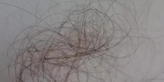 ���^�l(f��)��(y��n)���a(b��)��ʲô�S���� ���^�l(f��)��(y��n)�����z����(w��n)�}��