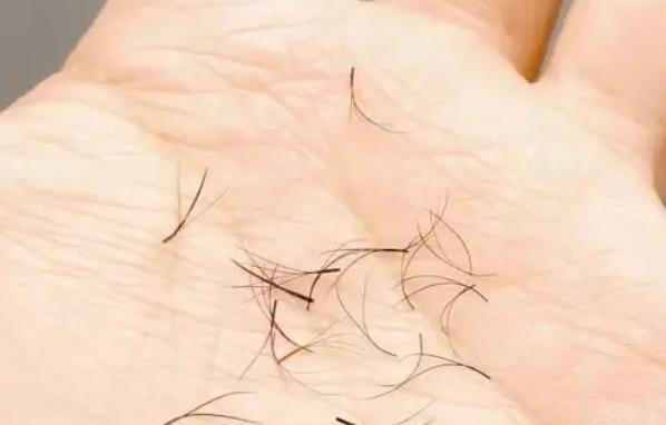 ��ë���˕����������L���� ���۽�ë��ʲôԭ��