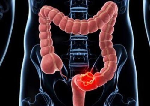 �����ԽY�c���ܹ����᣿�����ԽY�c�׶�ÏͲ�