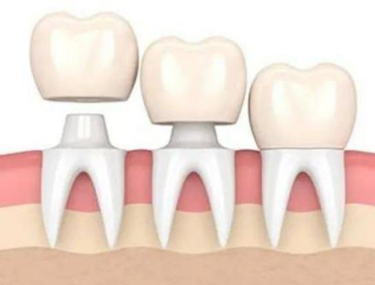 �Nֲ���X�֞�ׂ��A�����Nֲ���X��ʲôֻ�[��ʹ��