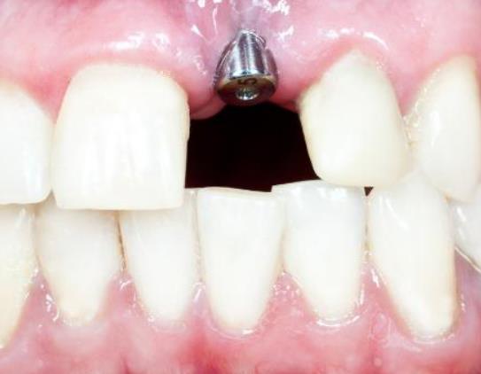 �C�����X��Σ����ʲô���Nֲ���X�ă�(y��u)�c