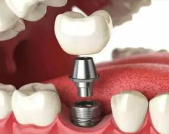 �C�����X��Σ����ʲô���Nֲ���X�ă�(y��u)�c(di��n)