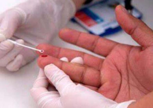 hiv��ˎҲ��ˎ�������Ć᣿��Ժ�C���������̲���