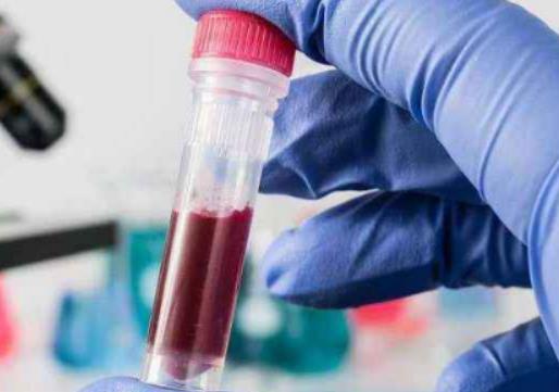 ���̲�Ҫ�������Ÿ�Ⱦ��HIV��Ⱦ�����籣߀��Ҫ�I���U��